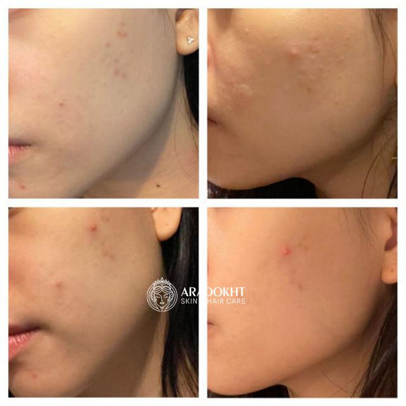 فوم شستشوی زیرو مدی‌ کیوب | MEDICUBE Zero Foam Cleanser - تصویر 5