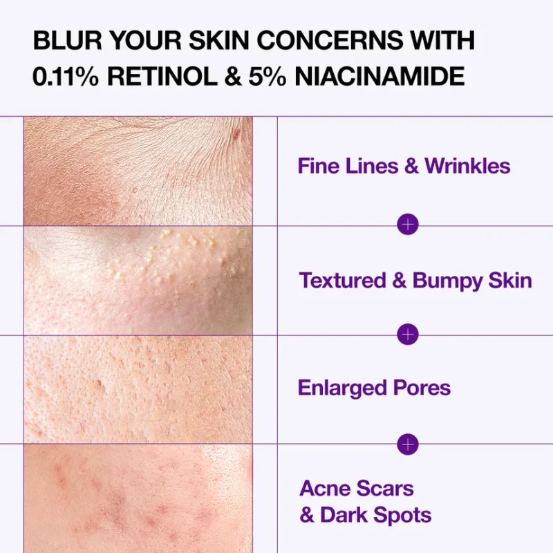 سرم نانو رتینول 0.3% آنوا  Anua Retinol 0.3% + Niacin Renewing Serum - تصویر 2