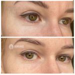 پک اختصاصی دور چشم مری اند می روشن کننده، آبرسان و ضدلک (گلوتاتیون و ترانگزامیک اسید) - تصویر 4