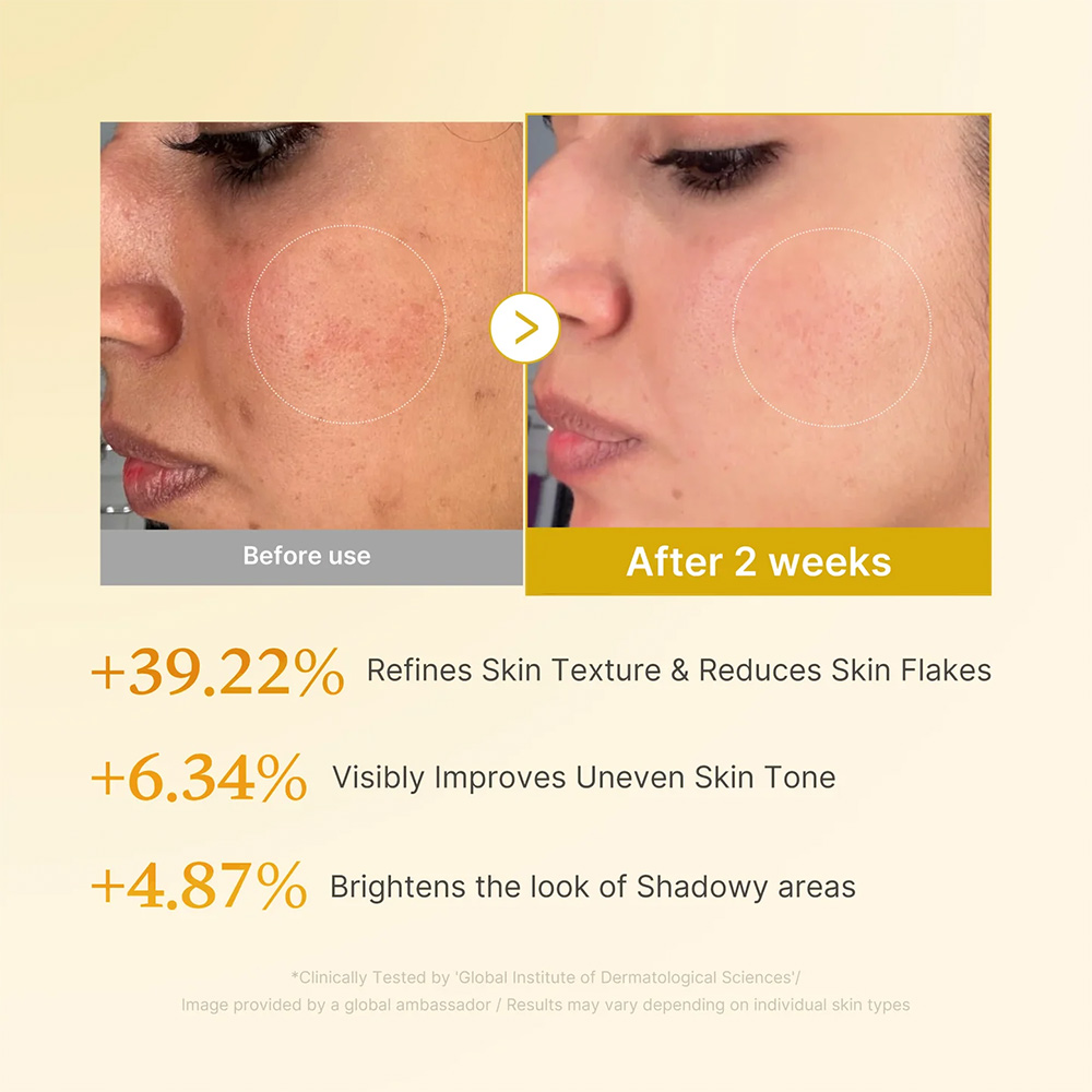 Medicube-Kojic-Acid-Turmeric-Resurfacing-Toner-8 تونر ترمیم کننده و روشن کننده کوجیک اسید و زردچوبه مدی کیوب - تصویر 3